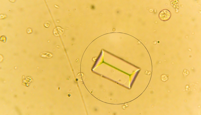 cristal de struvite dans l'urine d'un chien, sous le microscope